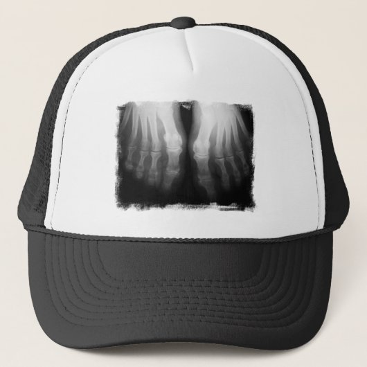X-Ray Feet Human Skeleton Botten zwart-wit Trucker Pet (Voorkant)