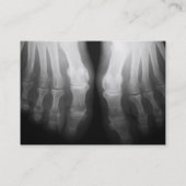 X-Ray Feet Human Skeleton Botten zwart-wit Visitekaartje (Achterkant)