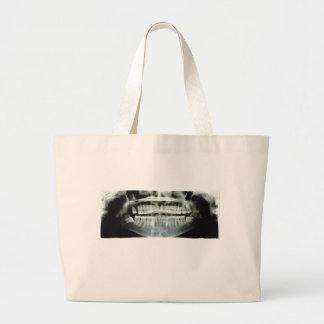X-Ray Grote Tote Bag