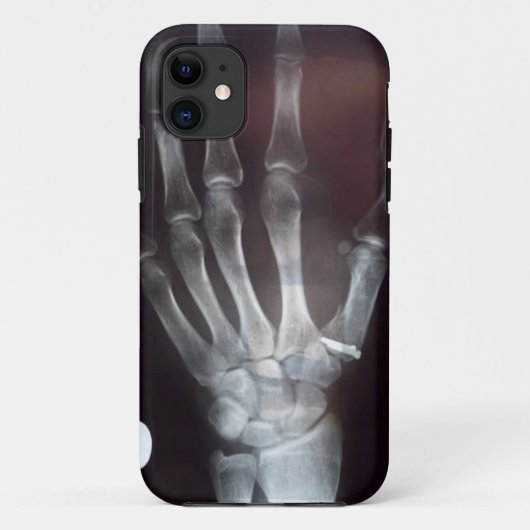 X-Ray Hand Telefoonhoes Case-Mate iPhone Case (Achterkant)