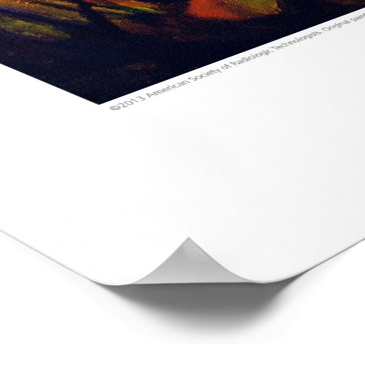 X-ray Hoesje kunst - Metacarpal Birch van L. Raine Poster (Hoek)