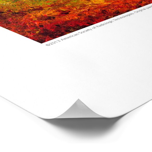 X-ray Hoesje kunst - Old Oak Chest CT by L. Rainey Poster (Hoek)