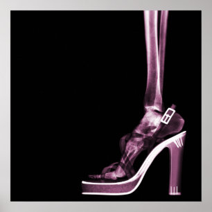 X-RAY HOGE HOOGHOOGHOOGHOOGHOOGHOOGWAARDIG SKELETO POSTER