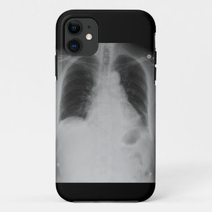X Ray ~ iPhone 5 CaseMate-hoesje Case-Mate iPhone Case