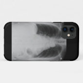 X Ray ~ iPhone 5 CaseMate-hoesje Case-Mate iPhone Case (Achterkant (horizontaal))