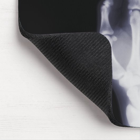 X-Ray Mousepad Muismat (Hoek)