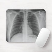 X-Ray Mousepad Muismat (Met muis)