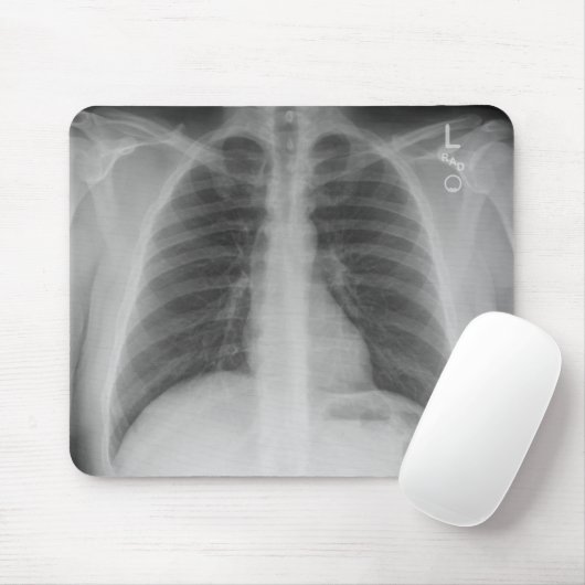 X-Ray Mousepad Muismat (Met muis)