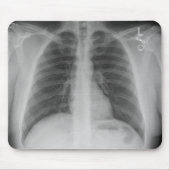 X-Ray Mousepad Muismat (Voorkant)