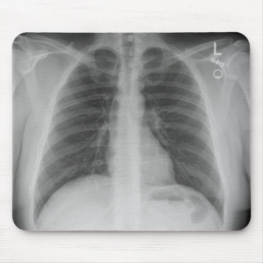 X-Ray Mousepad Muismat (Voorkant)