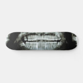 X-Ray Persoonlijk Skateboard (Horizontaal)