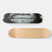 X-Ray Persoonlijk Skateboard (Horizontaal)