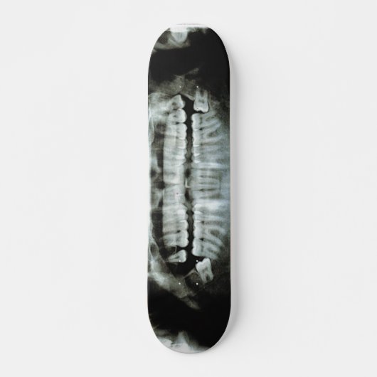 X-Ray Persoonlijk Skateboard (Voorkant)