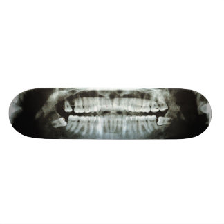 X-Ray Persoonlijk Skateboard