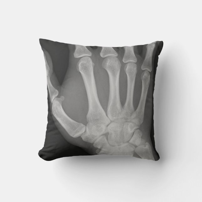 X-Ray Pillow Kussen (Voorkant)