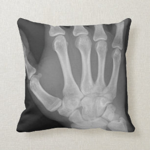 X-Ray Pillow Kussen