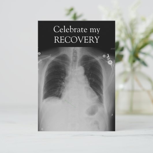 X Ray Recovery ~ uitnodiging (Staand voorkant)