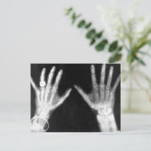 X-Ray Skelethandjes en juwelen - B&W Briefkaart (Staand voorkant)