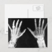 X-Ray Skelethandjes en juwelen - B&W Briefkaart (Voorkant / Achterkant)
