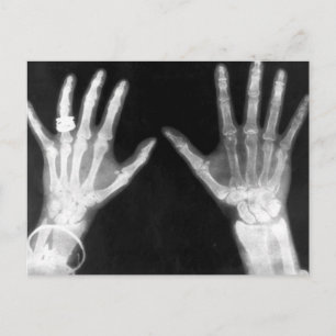 X-Ray Skelethandjes en juwelen - B&W Briefkaart