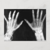 X-Ray Skelethandjes en juwelen - B&W Briefkaart (Voorkant)