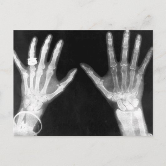 X-Ray Skelethandjes en juwelen - B&W Briefkaart (Voorkant)