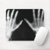 X-Ray Skelethandjes en juwelen - B&W Muismat (Met muis)