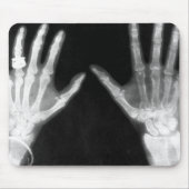 X-Ray Skelethandjes en juwelen - B&W Muismat (Voorkant)
