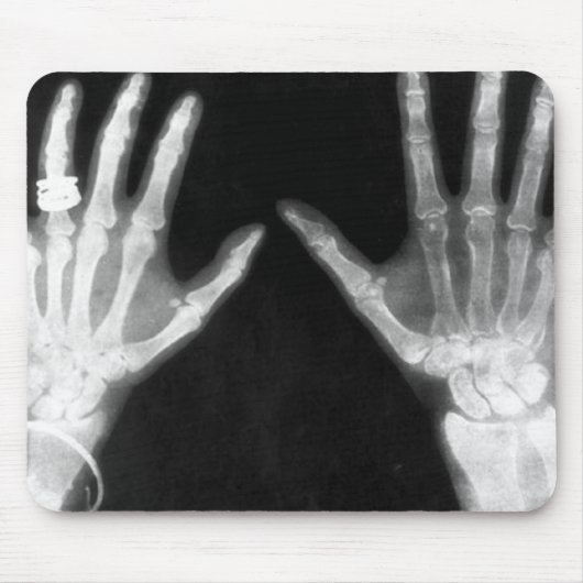 X-Ray Skelethandjes en juwelen - B&W Muismat (Voorkant)
