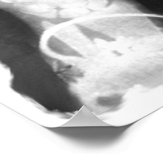 X-Ray Skelethandjes en juwelen - B&W Poster (Hoek)