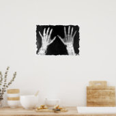 X-Ray Skelethandjes en juwelen - B&W Poster (Keuken)