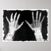 X-Ray Skelethandjes en juwelen - B&W Poster (Voorkant)