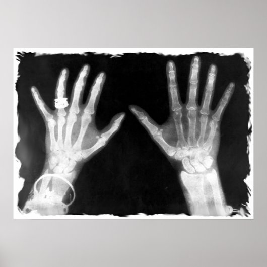 X-Ray Skelethandjes en juwelen - B&W Poster (Voorkant)