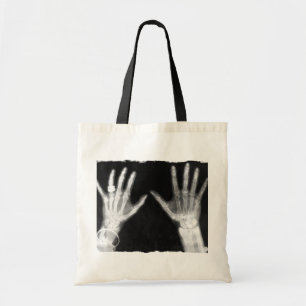 X-Ray Skelethandjes en juwelen - B&W Tote Bag