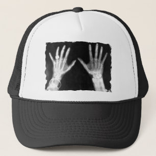 X-Ray Skelethandjes en juwelen - B&W Trucker Pet