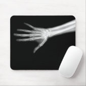 X-RAY SKELETON ARM B&W MUISMAT (Met muis)