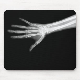X-RAY SKELETON ARM B&W MUISMAT