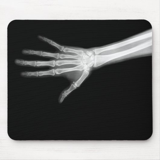 X-RAY SKELETON ARM B&W MUISMAT (Voorkant)