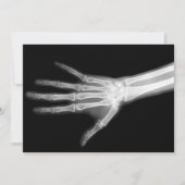 X-Ray Skeleton Arms Zwart-wit Kaart (Voorkant)