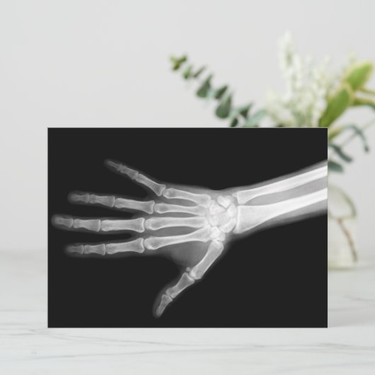 X-Ray Skeleton Arms Zwart-wit Kaart (Staand voorkant)