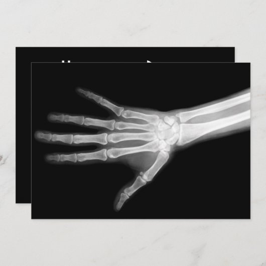 X-Ray Skeleton Arms Zwart-wit Kaart (Voorkant / Achterkant)