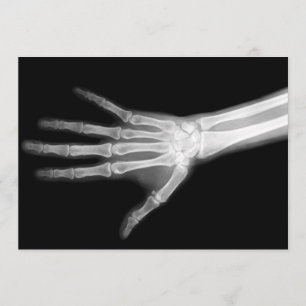 X-Ray Skeleton Arms Zwart-wit Kaart
