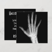 X-Ray Skeleton Arms Zwart-wit Kaart (Voorkant / Achterkant)