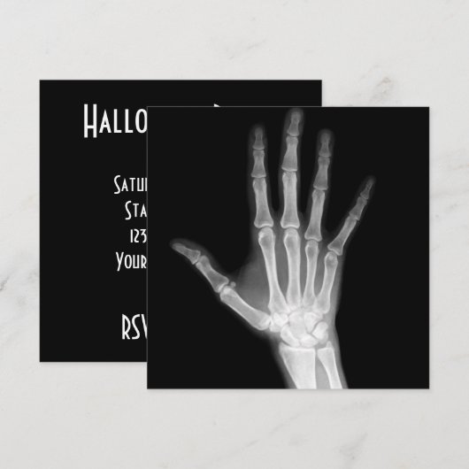 X-Ray Skeleton Arms Zwart-wit Kaart (Voorkant / Achterkant)