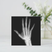 X-Ray Skeleton Arms Zwart-wit Kaart (Staand voorkant)