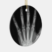 X-RAY SKELETON HAND FINGERS B&W KERAMISCH ORNAMENT (Rechts)