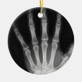 X-RAY SKELETON HAND FINGERS B&W KERAMISCH ORNAMENT (Voorkant)