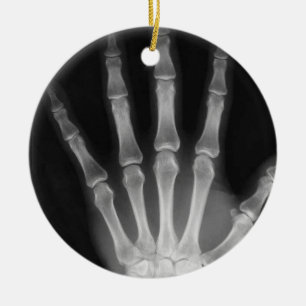 X-RAY SKELETON HAND FINGERS B&W KERAMISCH ORNAMENT