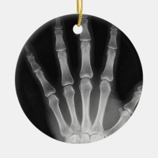 X-RAY SKELETON HAND FINGERS B&W KERAMISCH ORNAMENT (Voorkant)