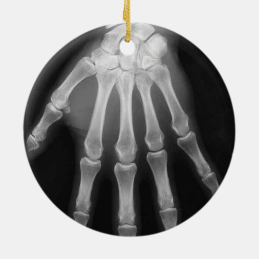 X-RAY SKELETON HAND FINGERS B&W KERAMISCH ORNAMENT (Achterkant)